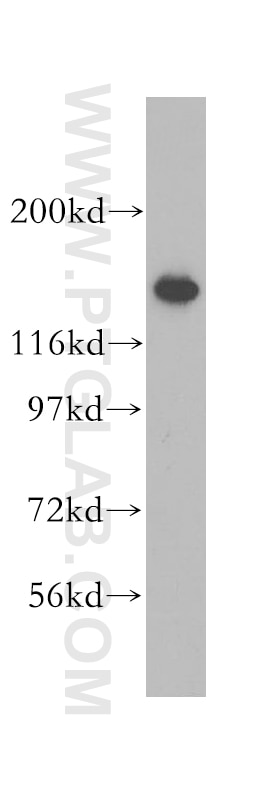 Western Blot (WB) analysis of A549 cells using CCP1 Polyclonal antibody (14067-1-AP)