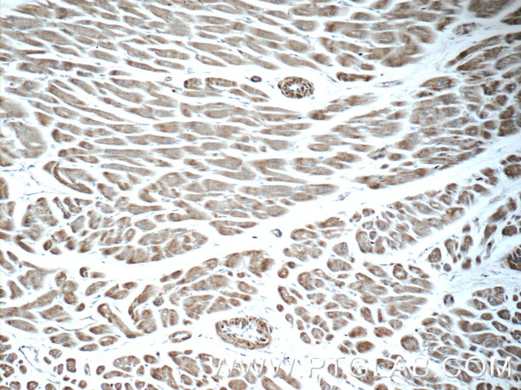 Immunohistochemistry (IHC) staining of human heart tissue using AGTR1 Polyclonal antibody (25343-1-AP)