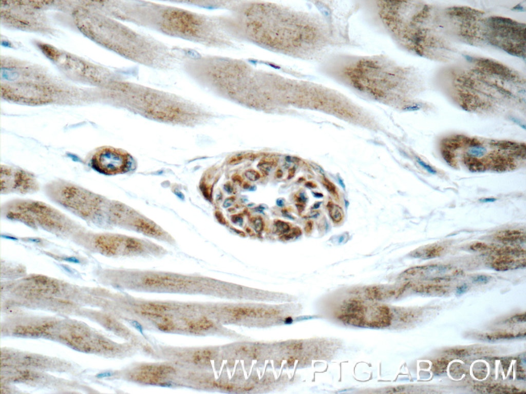 Immunohistochemistry (IHC) staining of human heart tissue using AGTR1 Polyclonal antibody (25343-1-AP)