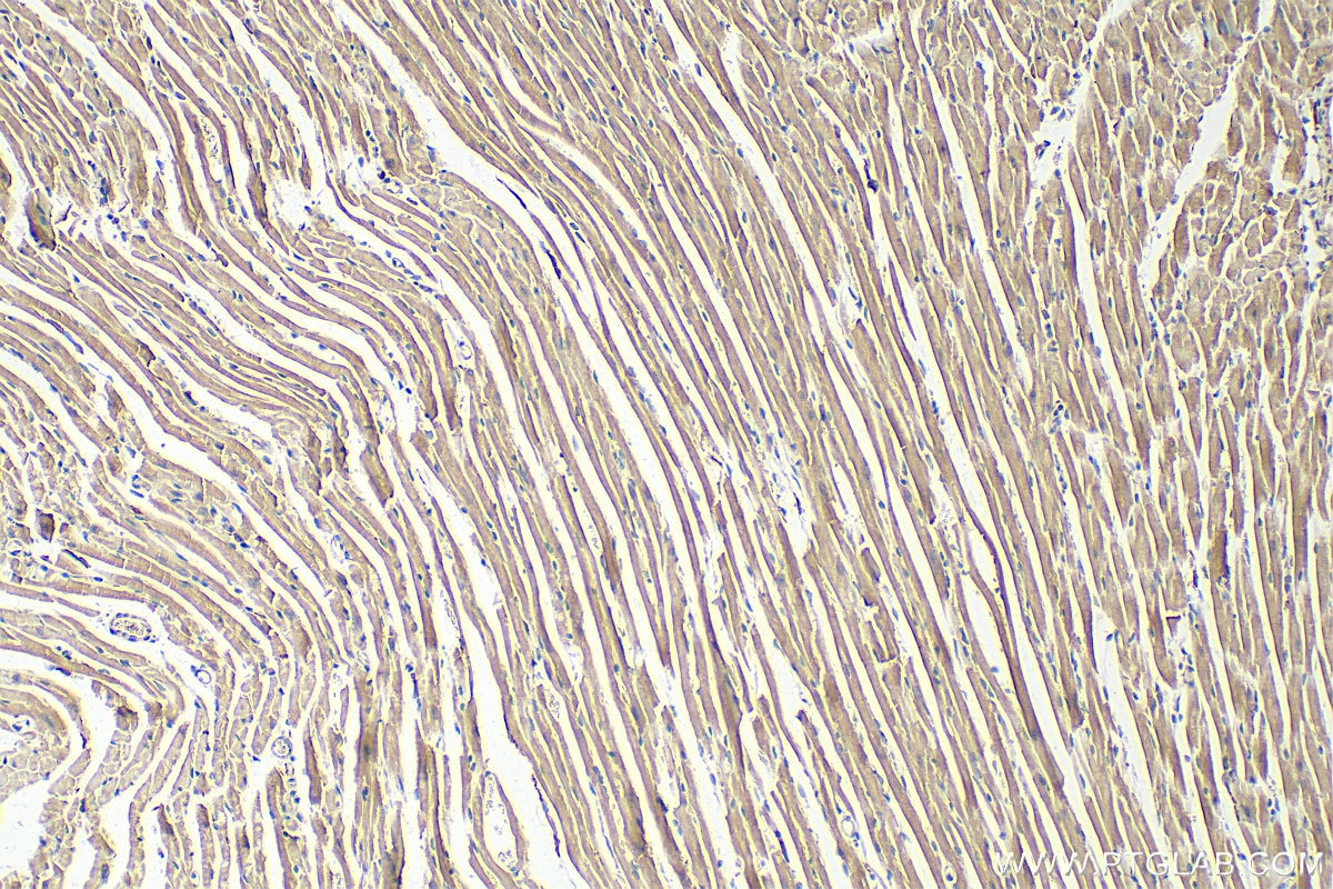 Immunohistochemistry (IHC) staining of mouse heart tissue using AGTR1 Polyclonal antibody (25343-1-AP)
