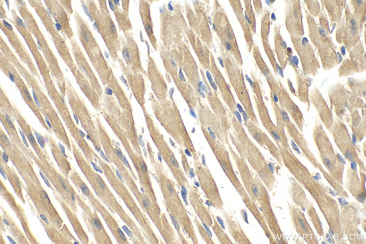 Immunohistochemistry (IHC) staining of mouse heart tissue using AGTR1 Polyclonal antibody (25343-1-AP)