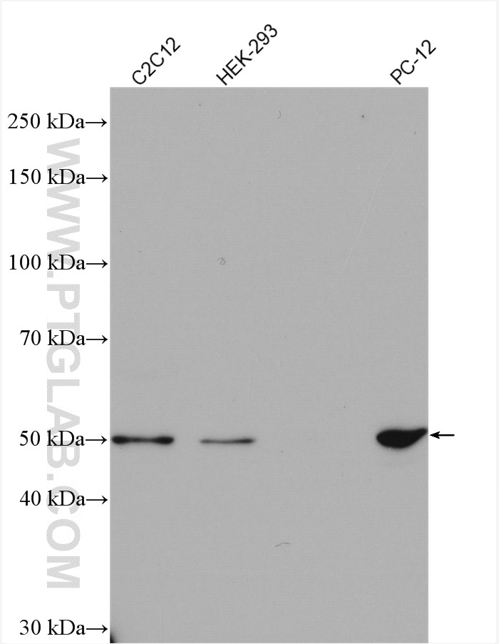 Western Blot (WB) analysis of various lysates using AGTR1 Polyclonal antibody (25343-1-AP)