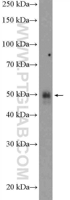 Western Blot (WB) analysis of mouse kidney tissue using AGTR1 Polyclonal antibody (25343-1-AP)