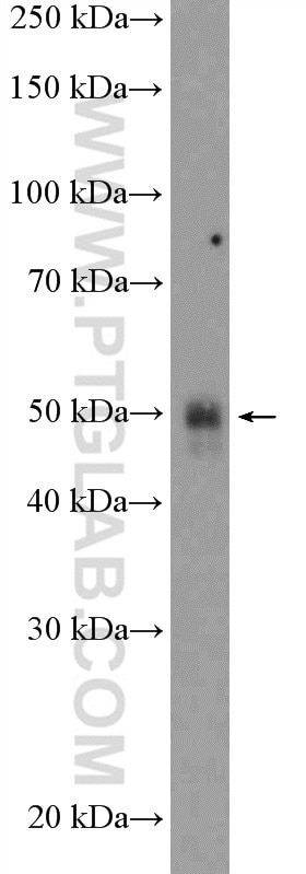 WB analysis of mouse kidney using 25343-1-AP