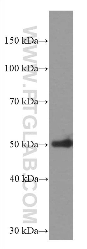 Western Blot (WB) analysis of pig skeletal muscle tissue using AGTR1 Monoclonal antibody (66415-1-Ig)