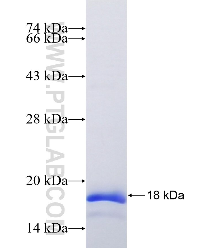 AGTR1 fusion protein Ag41562 SDS-PAGE AGTR1 fusion protein Ag41562 SDS-PAGE