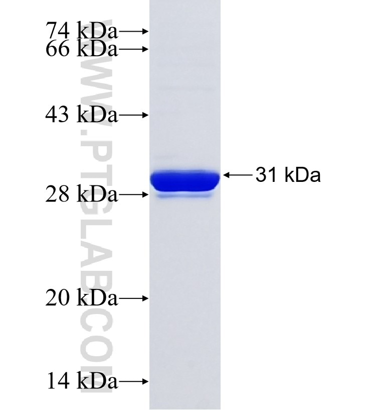 AGTR2 fusion protein Ag33887 SDS-PAGE