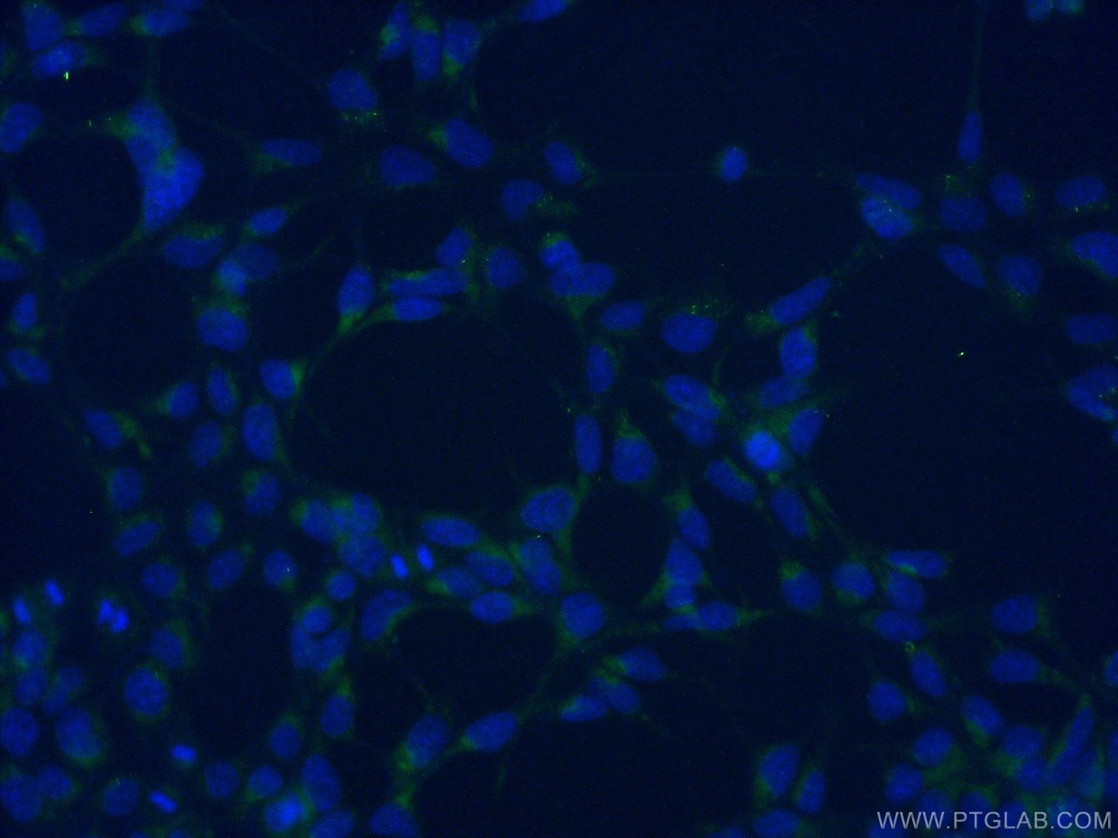 Immunofluorescence (IF) / fluorescent staining of HEK-293 cells using AGTRAP Polyclonal antibody (11559-1-AP)