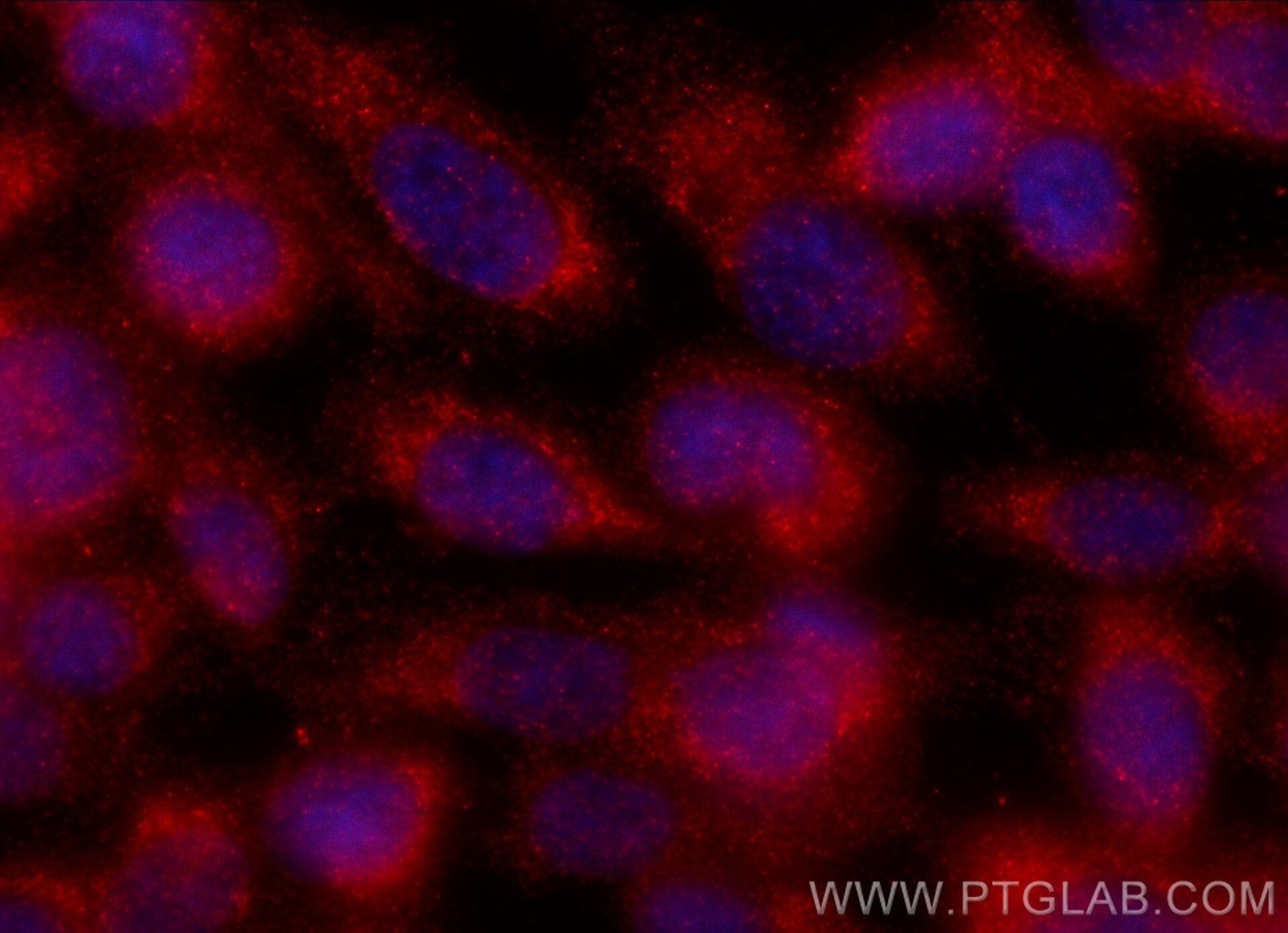 Immunofluorescence (IF) / fluorescent staining of PC-3 cells using AGTRAP Polyclonal antibody (11559-1-AP)