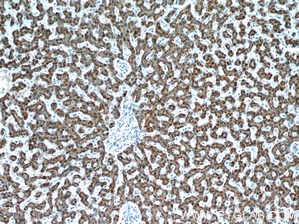 Immunohistochemistry (IHC) staining of human liver tissue using AGXT Polyclonal antibody (22394-1-AP)