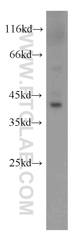 Western Blot (WB) analysis of mouse liver tissue using AGXT Polyclonal antibody (22394-1-AP)