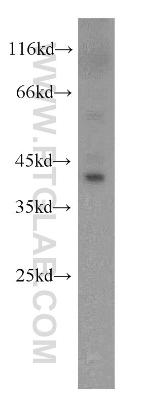 WB analysis of mouse liver using 22394-1-AP