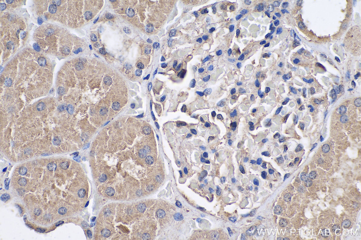 Immunohistochemistry (IHC) staining of human kidney tissue using AGXT Monoclonal antibody (67402-1-Ig)
