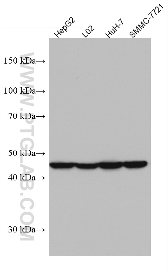 Western Blot (WB) analysis of various lysates using AGXT Monoclonal antibody (67402-1-Ig)