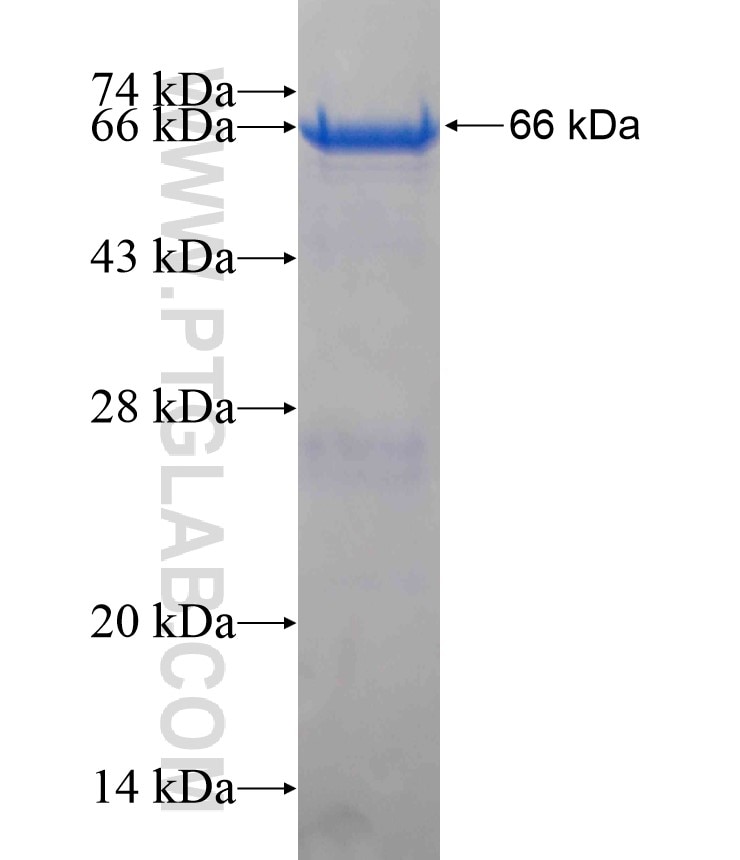 AGXT fusion protein Ag18062 SDS-PAGE