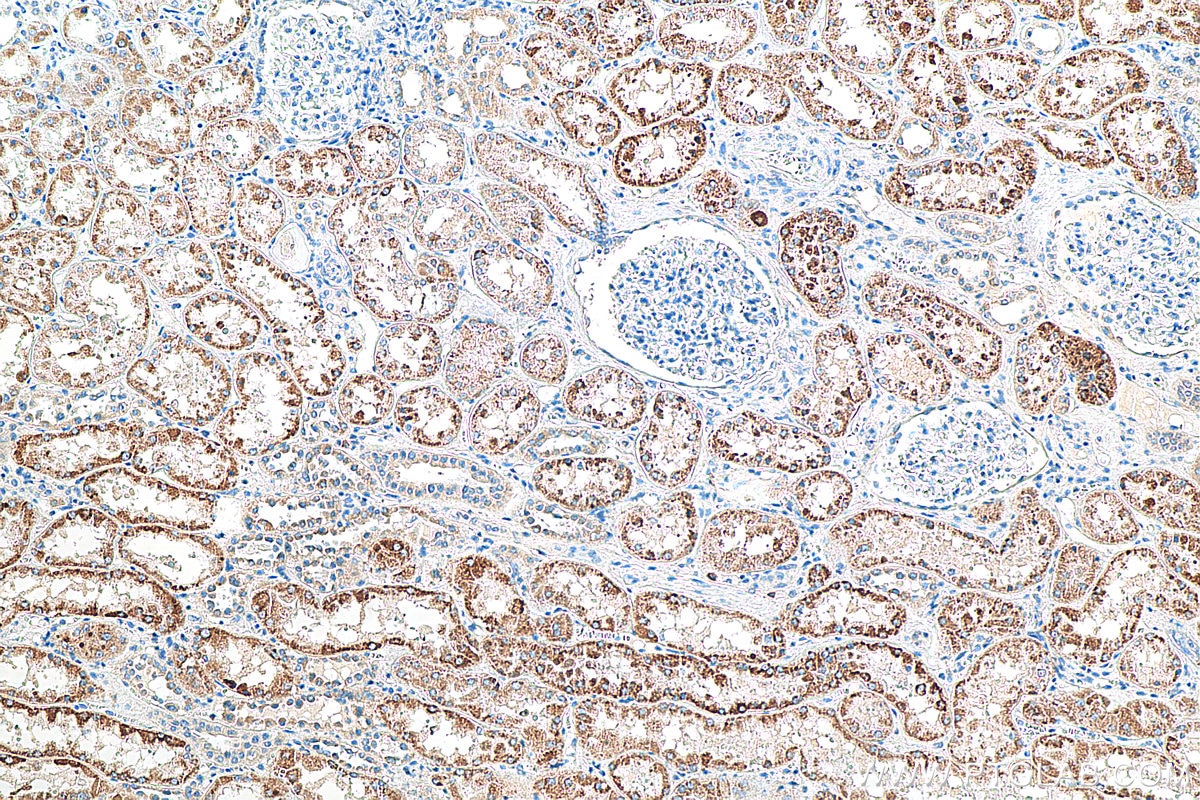 Immunohistochemistry (IHC) staining of human kidney tissue using AGXT2 Monoclonal antibody (66602-1-Ig)