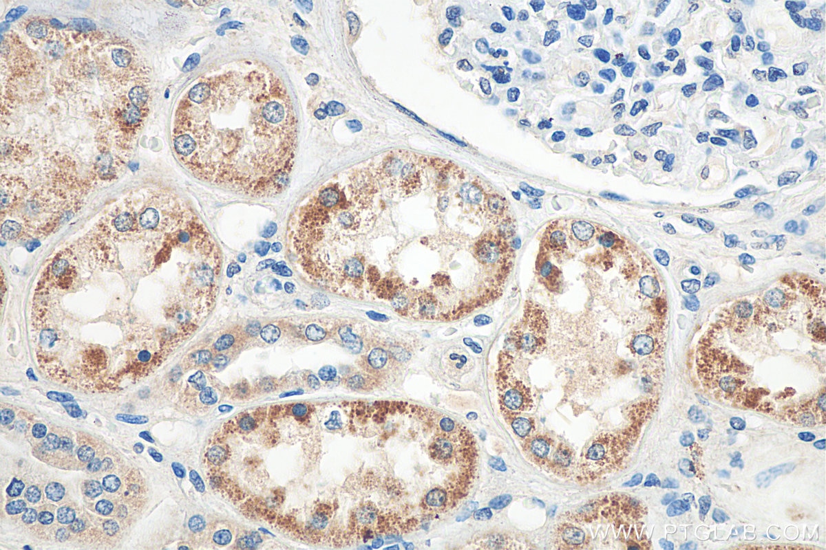 IHC staining of human kidney using 66602-1-Ig