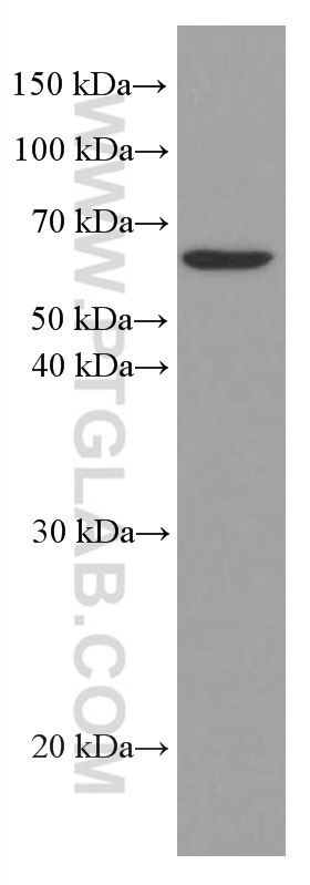 Western Blot (WB) analysis of Jurkat cells using AGXT2 Monoclonal antibody (66602-1-Ig)