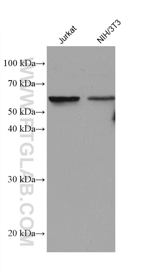 Western Blot (WB) analysis of various lysates using AGXT2 Monoclonal antibody (66602-1-Ig)