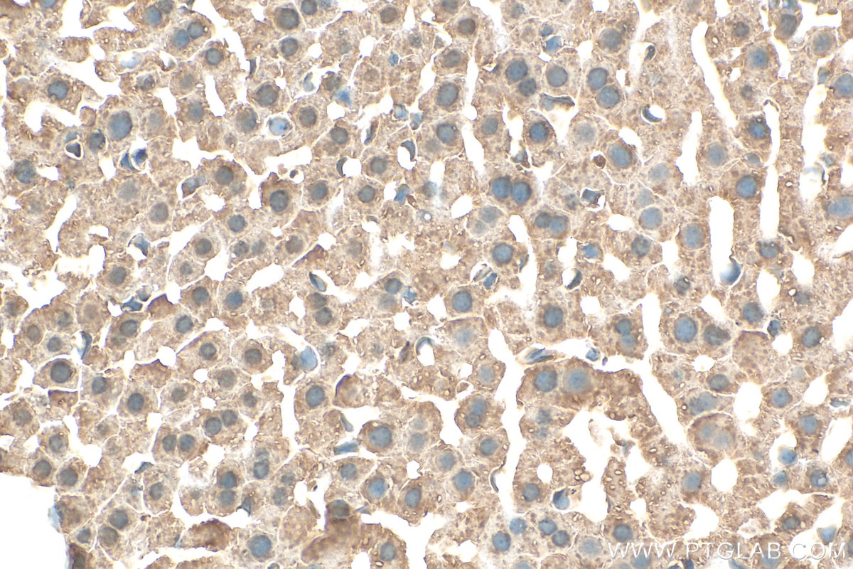 Immunohistochemistry (IHC) staining of mouse liver tissue using AGXT2L1 Polyclonal antibody (17042-1-AP)