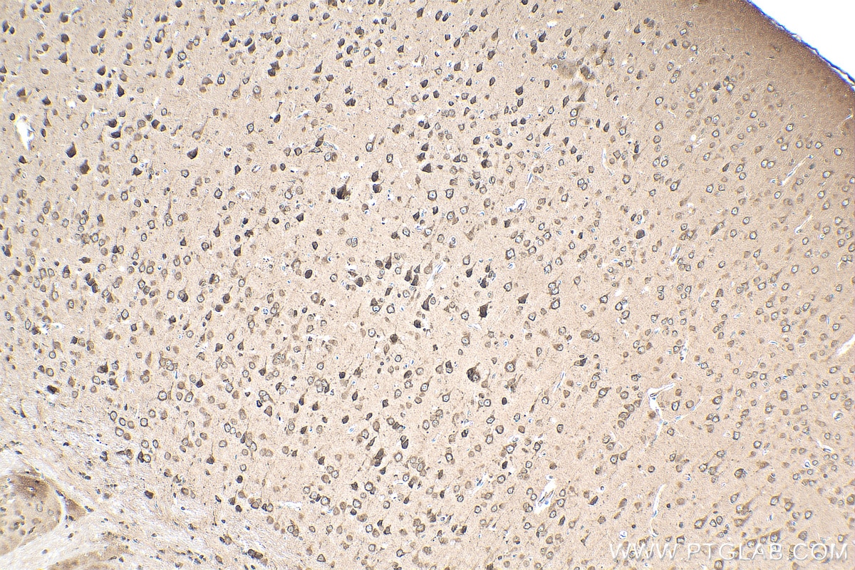 Immunohistochemistry (IHC) staining of mouse brain tissue using AGXT2L1 Polyclonal antibody (17042-1-AP)