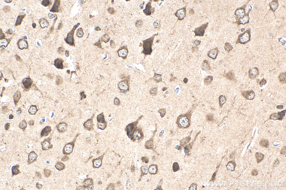 Immunohistochemistry (IHC) staining of mouse brain tissue using AGXT2L1 Polyclonal antibody (17042-1-AP)