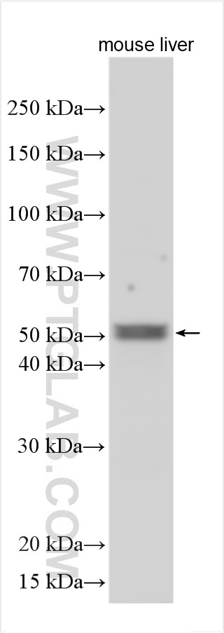 Western Blot (WB) analysis of various lysates using AGXT2L1 Polyclonal antibody (17042-1-AP)