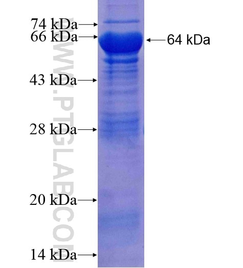 AGXT2L1 fusion protein Ag10584 SDS-PAGE