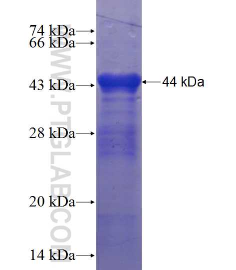AGXT2L1 fusion protein Ag10848 SDS-PAGE
