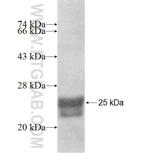 AGXT2L2 fusion protein Ag8374 SDS-PAGE