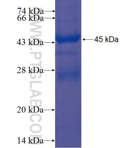 AGXT2L2 fusion protein Ag8391 SDS-PAGE