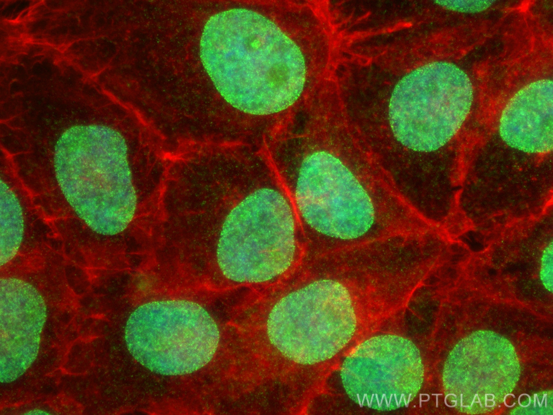Immunofluorescence (IF) / fluorescent staining of A431 cells using AHCTF1 Polyclonal antibody (30923-1-AP)