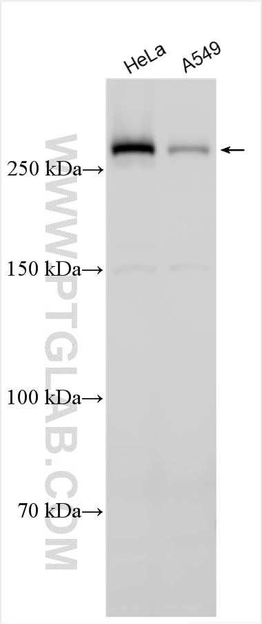 Western Blot (WB) analysis of various lysates using AHCTF1 Polyclonal antibody (30923-1-AP)