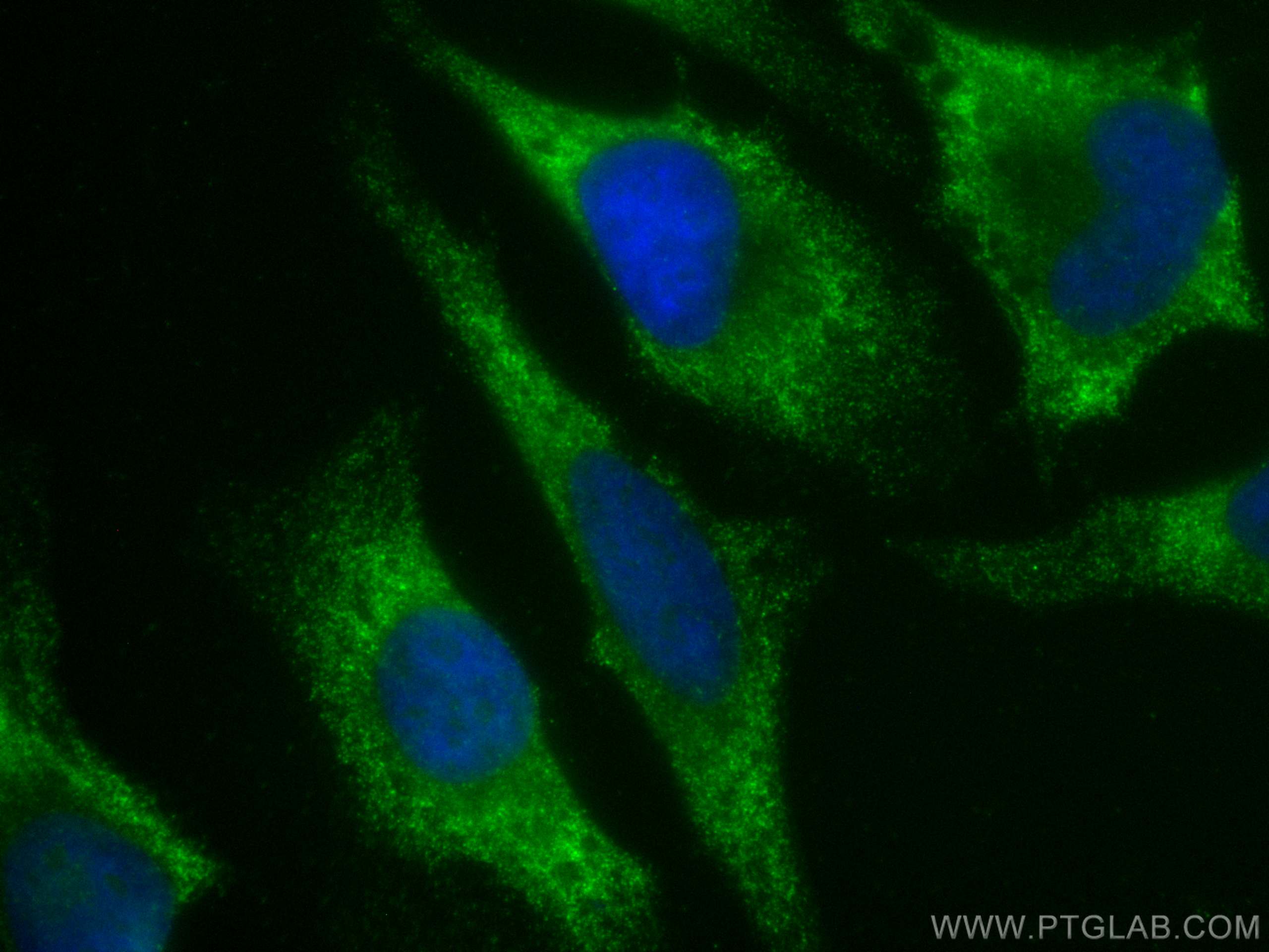 Immunofluorescence (IF) / fluorescent staining of HeLa cells using AHCY Monoclonal antibody (66019-1-Ig)