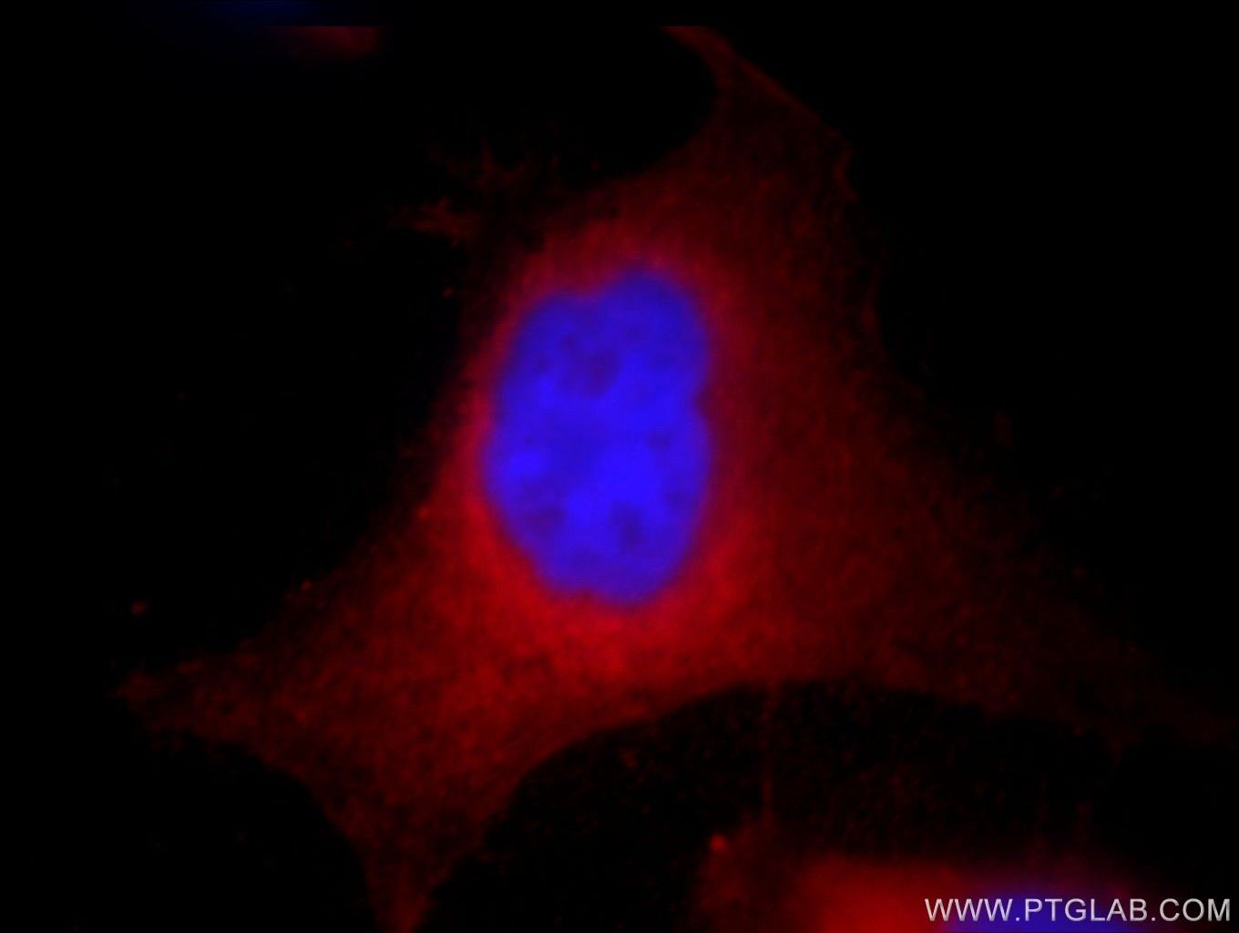 Immunofluorescence (IF) / fluorescent staining of HeLa cells using AHCY Monoclonal antibody (66019-1-Ig)