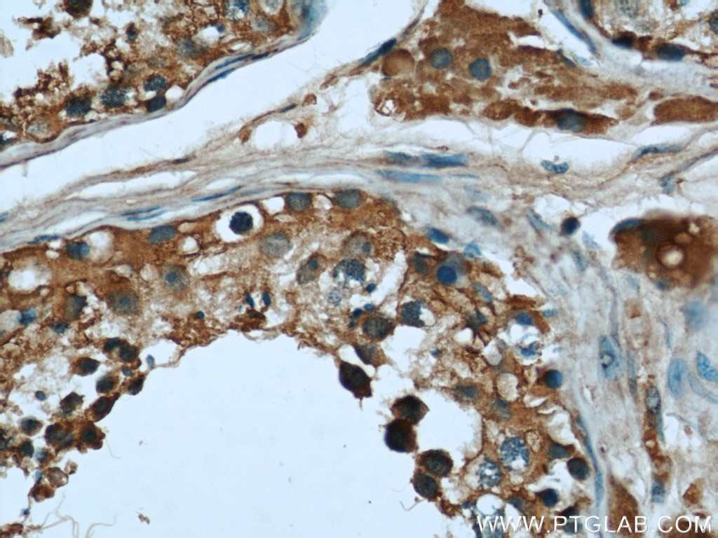 Immunohistochemistry (IHC) staining of human testis tissue using AHCY Monoclonal antibody (66019-1-Ig)
