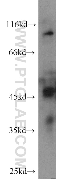 Western Blot (WB) analysis of human testis tissue using AHCY Monoclonal antibody (66019-1-Ig)