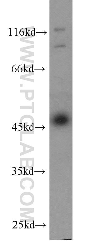 WB analysis of HeLa using 66019-1-Ig