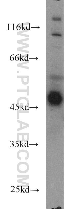 Western Blot (WB) analysis of MCF-7 cells using AHCY Monoclonal antibody (66019-1-Ig)