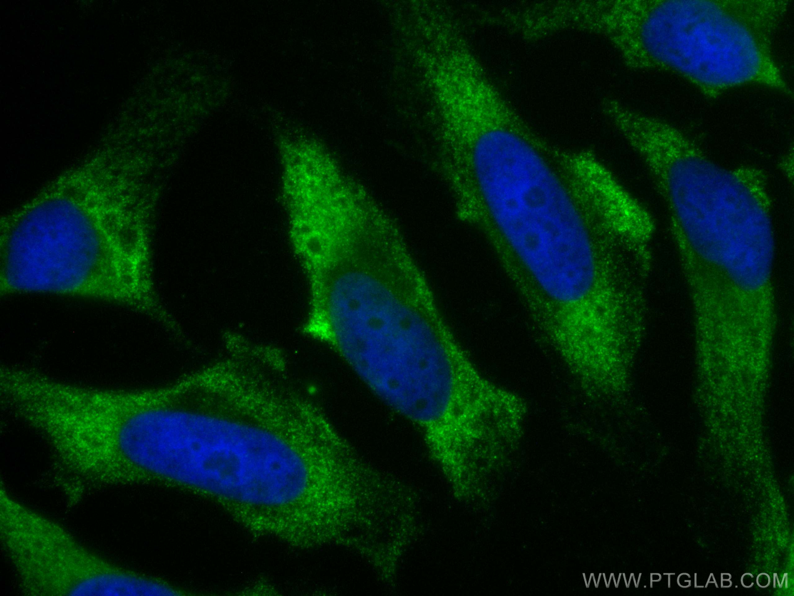 IF Staining of HeLa using CL488-66019