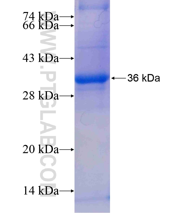 AHCY fusion protein Ag18036 SDS-PAGE