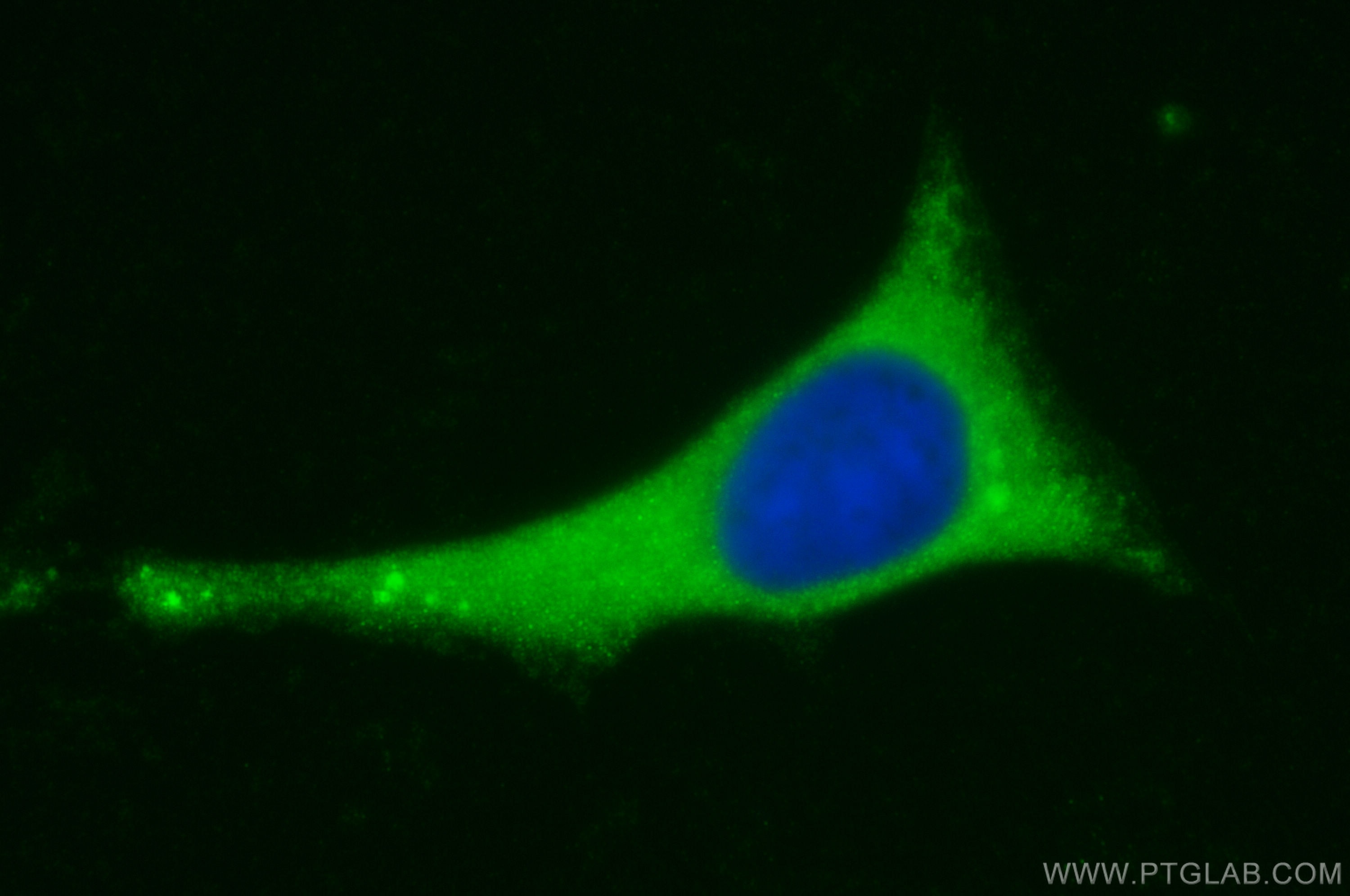 Immunofluorescence (IF) / fluorescent staining of HeLa cells using AHCYL1 Polyclonal antibody (10658-3-AP)