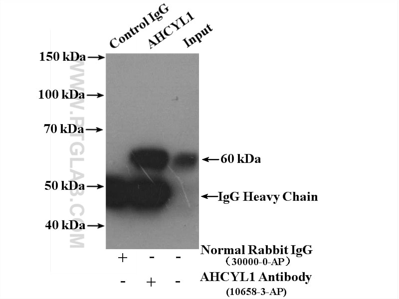 Immunoprecipitation (IP) experiment of HeLa cells using AHCYL1 Polyclonal antibody (10658-3-AP)