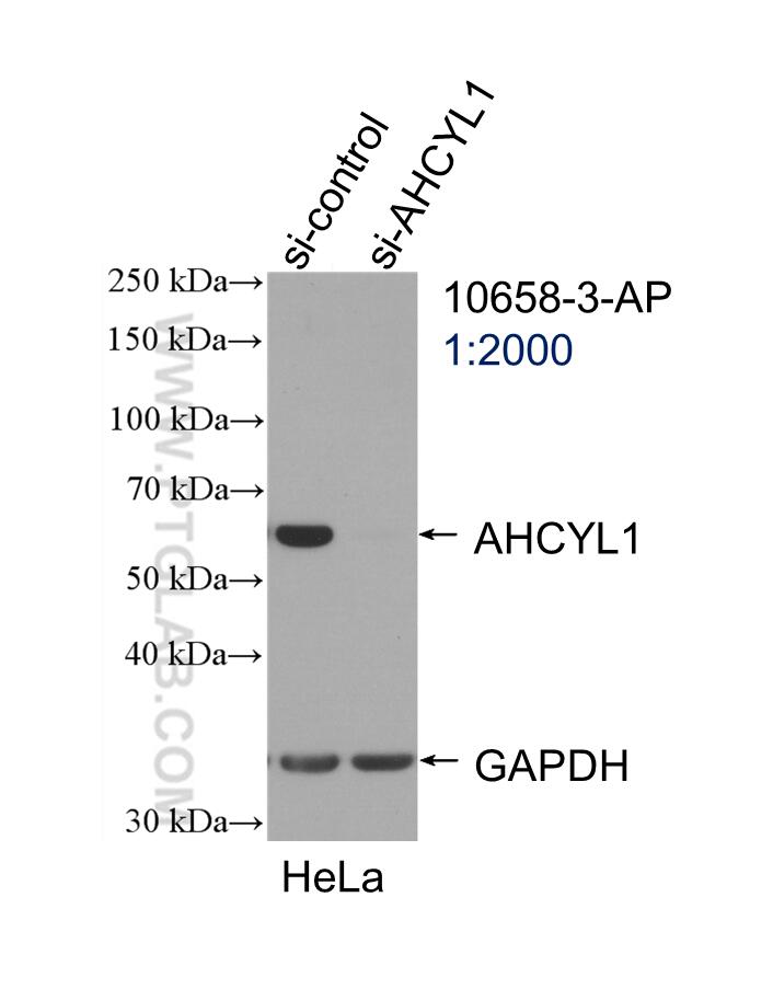 Western Blot (WB) analysis of HeLa cells using AHCYL1 Polyclonal antibody (10658-3-AP)