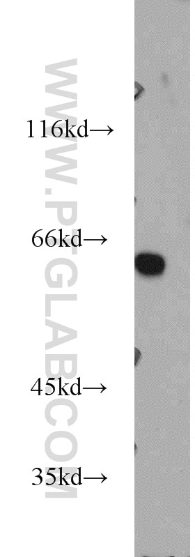Western Blot (WB) analysis of Jurkat cells using AHCYL1 Polyclonal antibody (10658-3-AP)