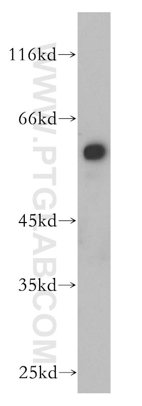 Western Blot (WB) analysis of mouse thymus tissue using AHCYL1 Polyclonal antibody (10658-3-AP)