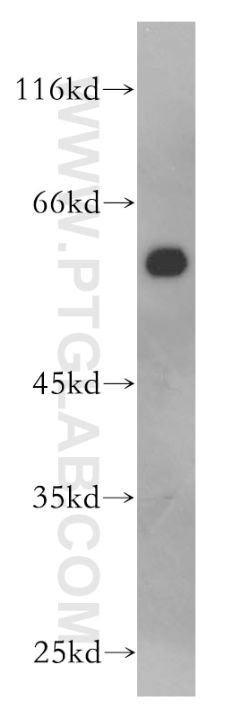 Western Blot (WB) analysis of HeLa cells using AHCYL1 Polyclonal antibody (10658-3-AP)