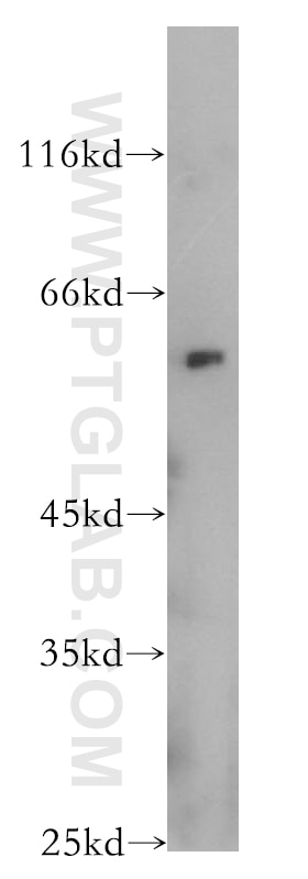 Western Blot (WB) analysis of Jurkat cells using AHCYL1 Polyclonal antibody (10658-3-AP)