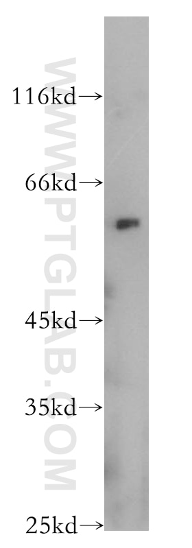 WB analysis of Jurkat using 10658-3-AP