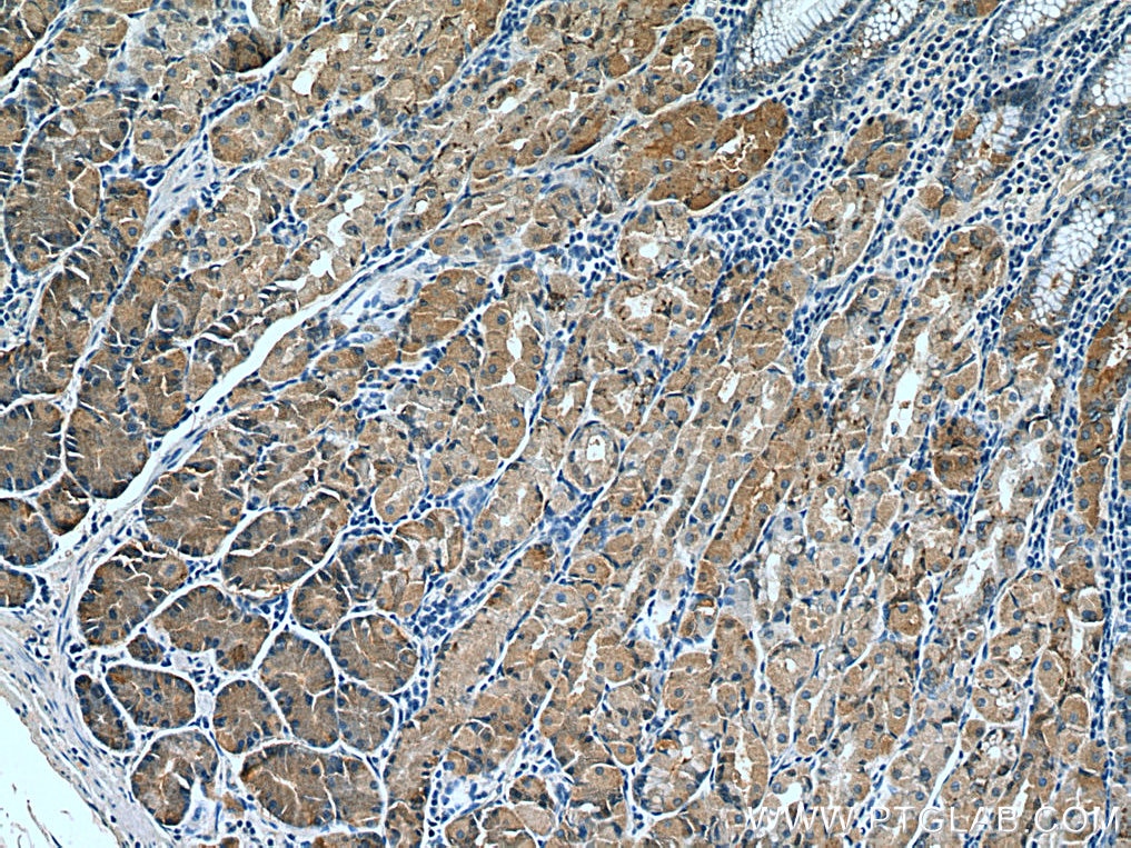 Immunohistochemistry (IHC) staining of human stomach tissue using AHCYL2 Monoclonal antibody (67484-1-Ig)